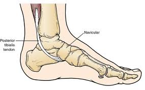 posterior tibial tendon