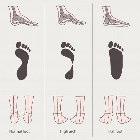 feet arches