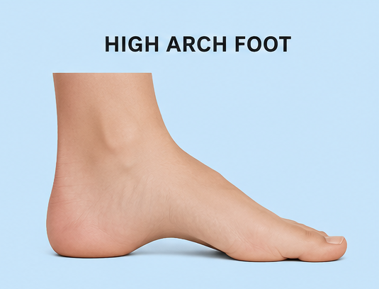 High arch foot type illustration